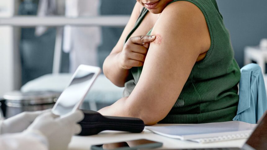 Diabetes and Infections
