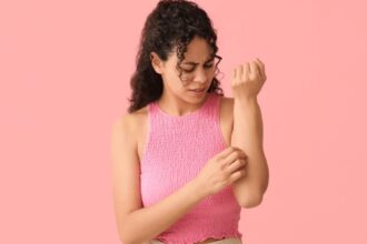 Cucumber to coriander: 10 home remedies for heat rash to soothe your skin