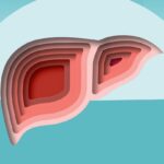 Heavy Drinking Is Fueling a Rise in Liver Disease, Especially in Women