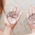 International Alopecia Day 2025: Cosmetic surgeon explains why autoimmune hair loss is rising