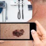 Is your skin app misleading you? Why seeing a dermatologist is necessary