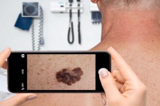 Is your skin app misleading you? Why seeing a dermatologist is necessary