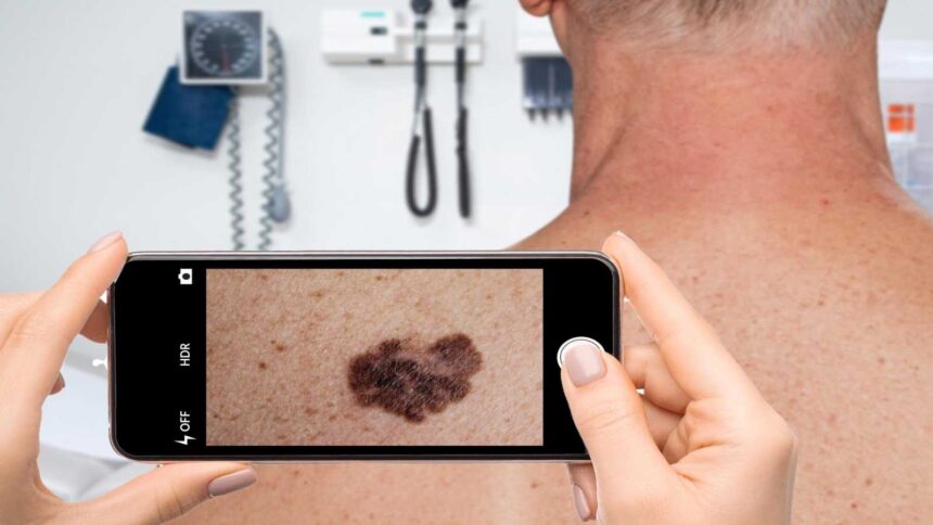 Is your skin app misleading you? Why seeing a dermatologist is necessary