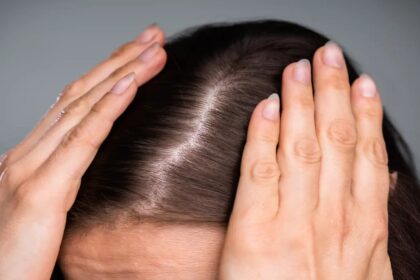 7 reasons why you may experience hair fall during festive season and how to prevent it