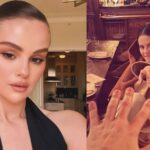 Selena Gomez reveals lupus caused arthritis in her fingers! Know if you are at risk too