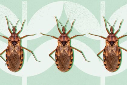 ‘Kissing Bug’ Disease Has Found a Home in the U.S.