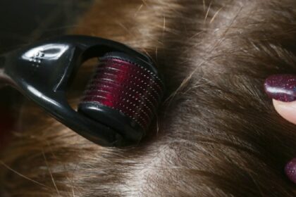 Thinking about a derma roller for hair growth? Here’s how to start