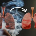 Air pollution, smoking, and nagging cough: When to get a lung function test?