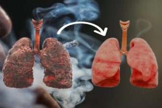 Air pollution, smoking, and nagging cough: When to get a lung function test?