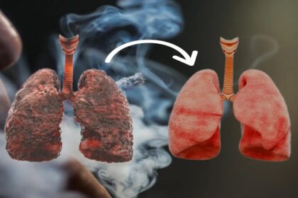 Air pollution, smoking, and nagging cough: When to get a lung function test?