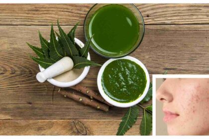 How to use neem to reduce acne and pimples without wrecking your skin