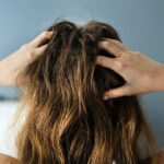 20 Remedies for Scalp Psoriasis Itch and Irritation