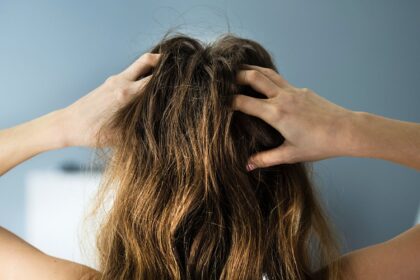 20 Remedies for Scalp Psoriasis Itch and Irritation