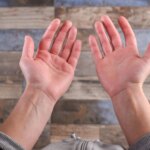 Red Palms? Here’s What Your Body Is Trying to Tell You