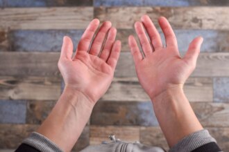 Red Palms? Here’s What Your Body Is Trying to Tell You