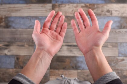 Red Palms? Here’s What Your Body Is Trying to Tell You