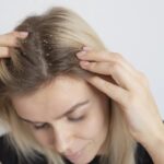 Tired of oily and sticky dandruff? Here are 6 quick fixes you need