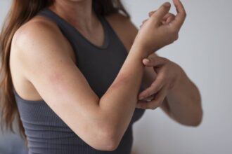 How colloidal oatmeal and ceramides can beat eczema? A dermatologist answers