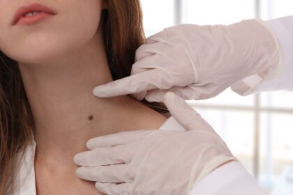 Naturopathic doctor shares 5 simple self-checks for early diabetes symptoms