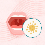 What Is Mononucleosis?