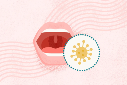What Is Mononucleosis?