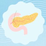 Can You Get a Pancreas Transplant for Type 1 Diabetes?