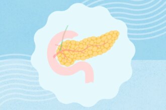 Can You Get a Pancreas Transplant for Type 1 Diabetes?