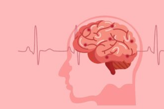 6 major causes of stroke in young adults, according to a cardiologist
