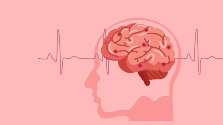 6 major causes of stroke in young adults, according to a cardiologist
