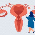 perimenopause symptoms in your thirties