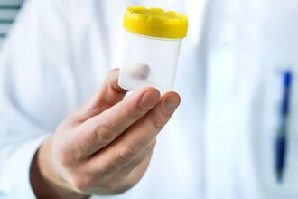 How a Kidney Infection Is Diagnosed