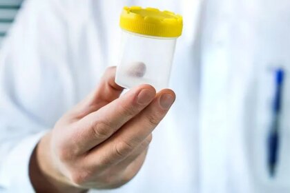 How a Kidney Infection Is Diagnosed