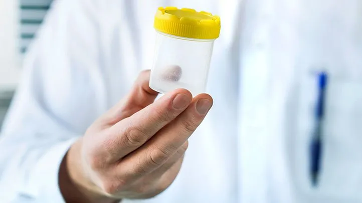 How a Kidney Infection Is Diagnosed