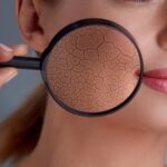 Winter skincare tips: Dermat says avoid long hot showers, apply richer creams