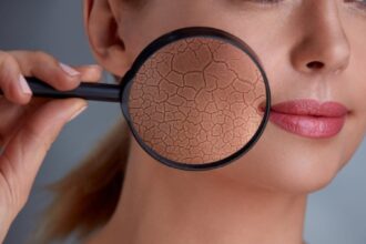 Winter skincare tips: Dermat says avoid long hot showers, apply richer creams