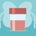 The IgAN Post-Infection Flare: Your Step-by-Step Action Plan