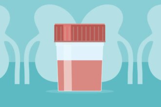 The IgAN Post-Infection Flare: Your Step-by-Step Action Plan