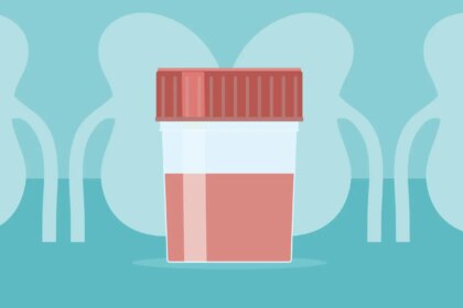 The IgAN Post-Infection Flare: Your Step-by-Step Action Plan