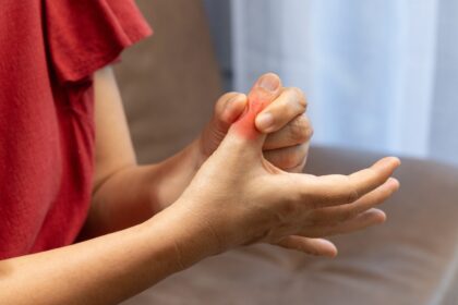 5 ways to reduce uric acid levels and prevent joint pain naturally