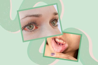 6 Unexpected Signs That Your Crohn’s Is Getting Worse