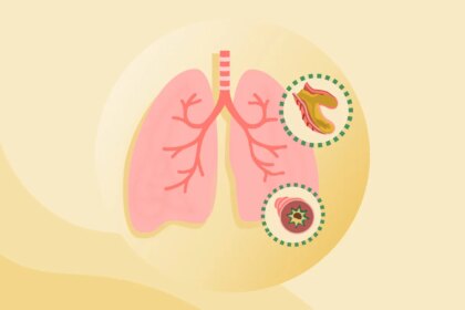 What Is Bronchiectasis?