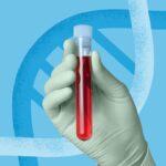 Genetic Testing and ATTR-CM: Everything You Need to Know