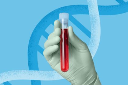 Genetic Testing and ATTR-CM: Everything You Need to Know