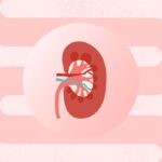 How Crohn’s Disease Can Affect Kidney Health