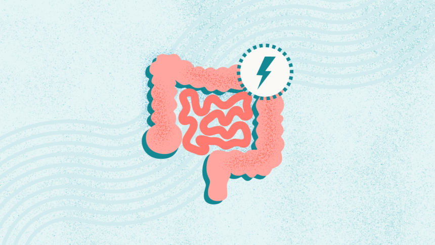 What Is Irritable Bowel Syndrome (IBS)?