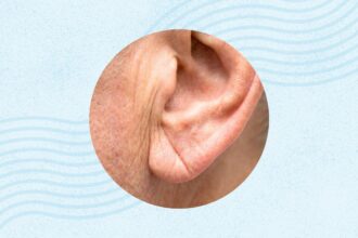 What Is Frank’s Sign? And What Does It Say About Your Heart?