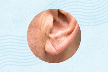 What Is Frank’s Sign? And What Does It Say About Your Heart?