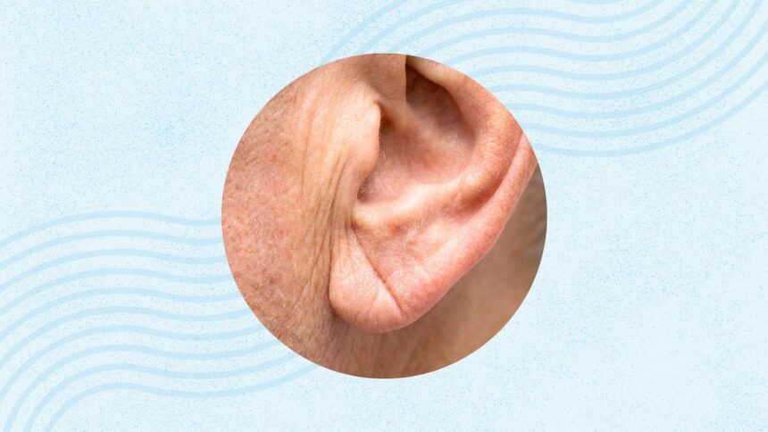 What Is Frank’s Sign? And What Does It Say About Your Heart?