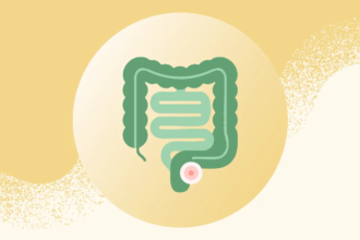 Rectal Cancer Is on the Rise Among Younger Adults — Here Are the Symptoms