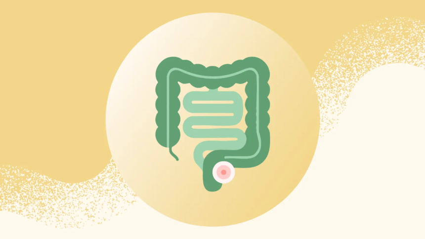 Rectal Cancer Is on the Rise Among Younger Adults — Here Are the Symptoms